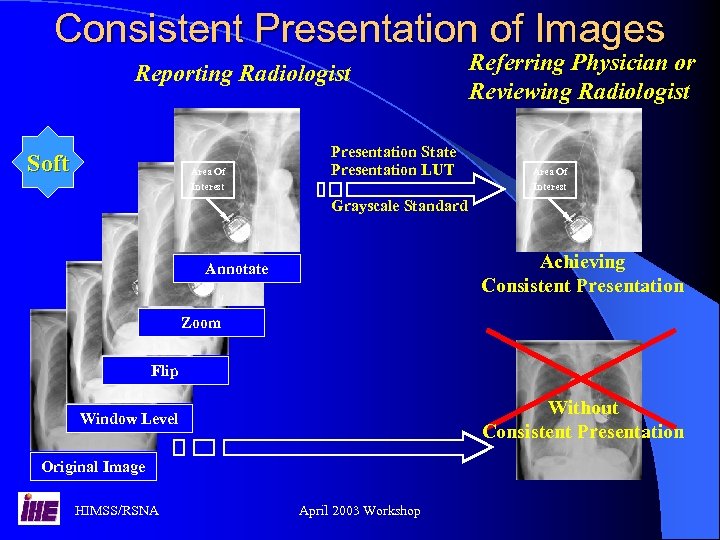 Consistent Presentation of Images Reporting Radiologist Soft Area Of Interest Presentation State Presentation LUT