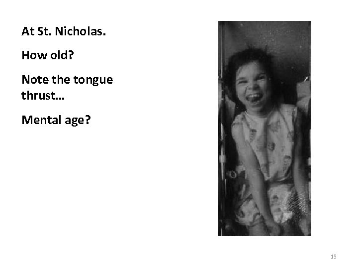 At St. Nicholas. How old? Note the tongue thrust… Mental age? 13 