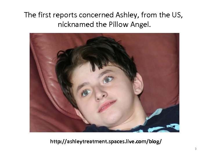 The first reports concerned Ashley, from the US, nicknamed the Pillow Angel. http: //ashleytreatment.