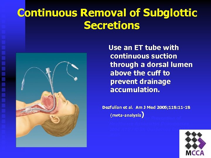 Continuous Removal of Subglottic Secretions Use an ET tube with continuous suction through a