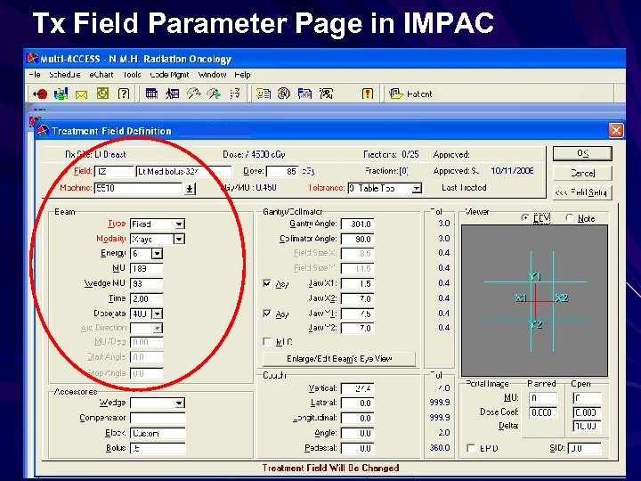 Tx Field Parameter Page in IMPAC 