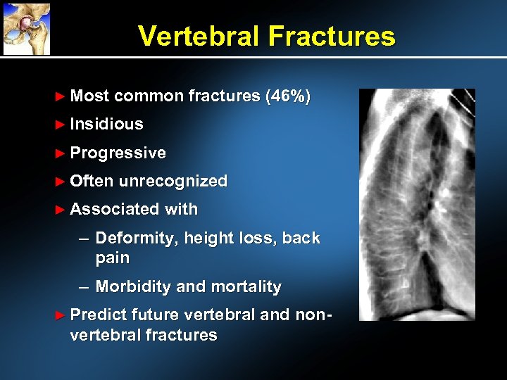 Vertebral Fractures ► Most common fractures (46%) ► Insidious ► Progressive ► Often unrecognized