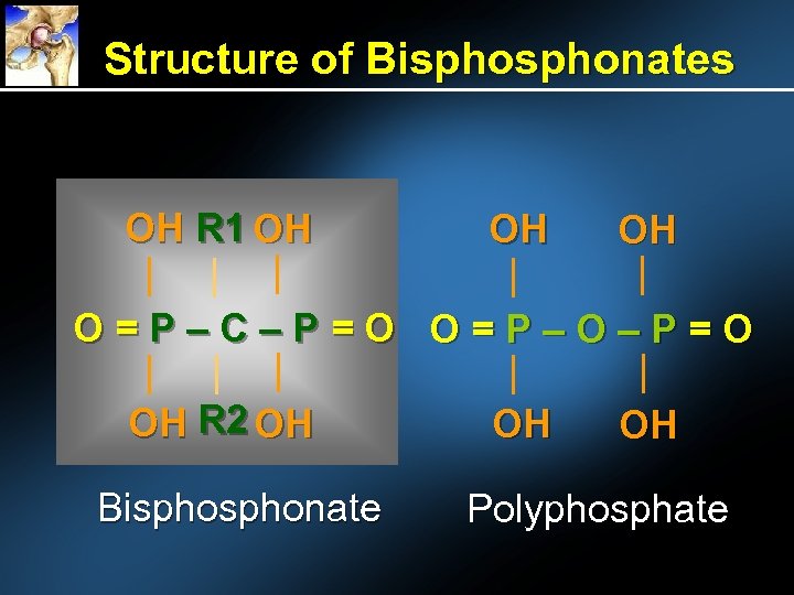Structure of Bisphonates OH R 1 OH OH OH O=P–C–P=O O=P–O–P=O OH R 2