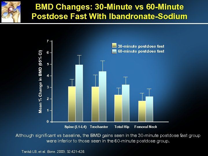 BMD Changes: 30 -Minute vs 60 -Minute Postdose Fast With Ibandronate-Sodium Mean % Change