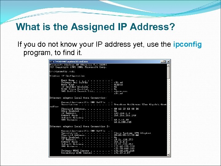 What is the Assigned IP Address? If you do not know your IP address