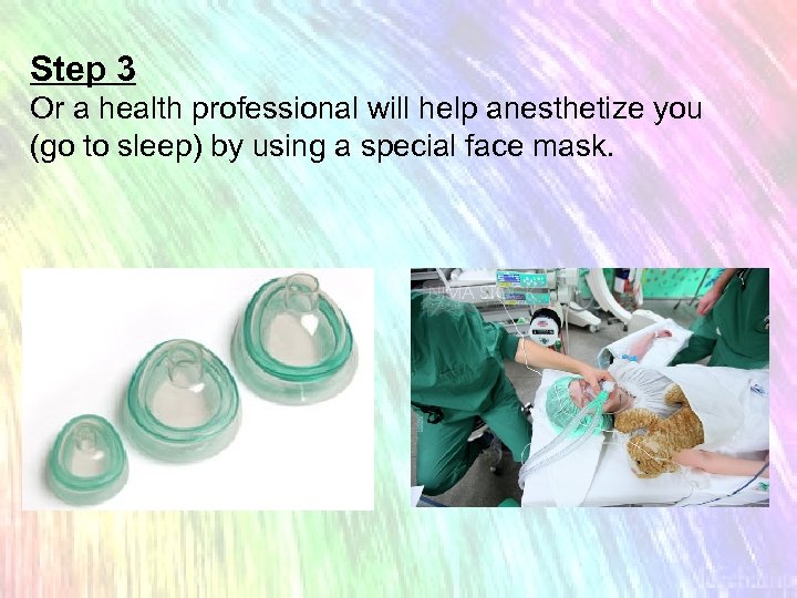 Step 3 Or a health professional will help anesthetize you (go to sleep) by