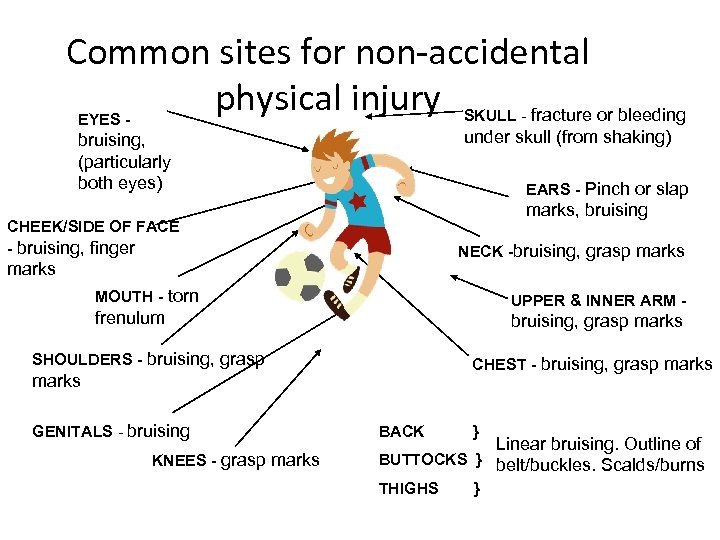 Common sites for non-accidental physical injury SKULL - fracture or bleeding EYES under skull