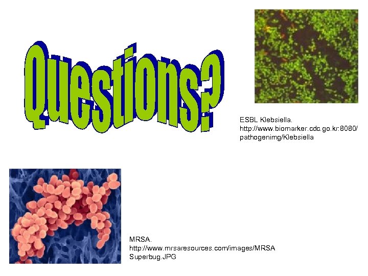 ESBL Klebsiella. http: //www. biomarker. cdc. go. kr: 8080/ pathogenimg/Klebsiella MRSA. http: //www. mrsaresources.