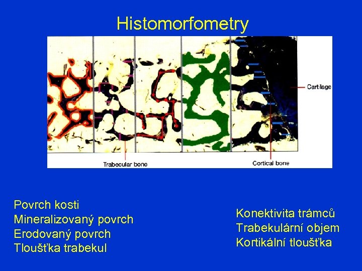 Histomorfometry Povrch kosti Mineralizovaný povrch Erodovaný povrch Tloušťka trabekul Konektivita trámců Trabekulární objem Kortikální