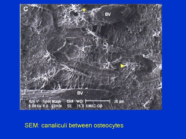 SEM: canaliculi between osteocytes 