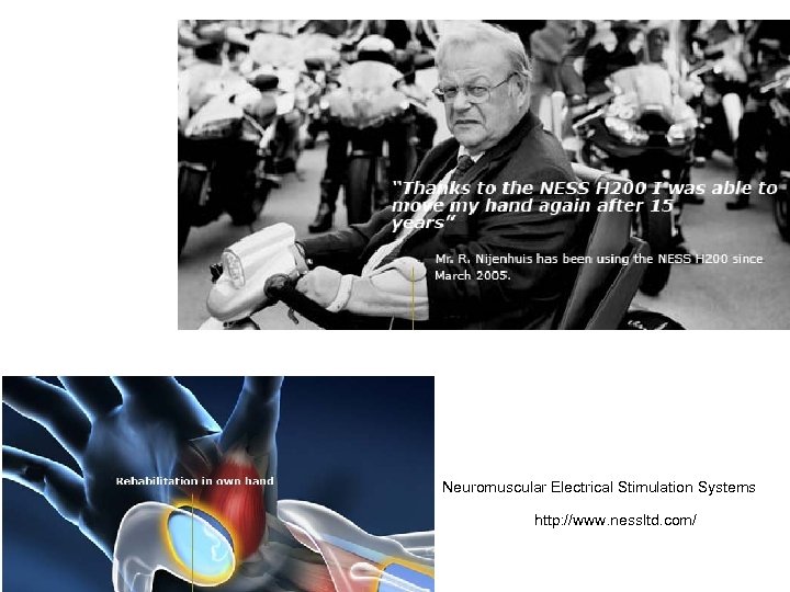 Neuromuscular Electrical Stimulation Systems http: //www. nessltd. com/ 