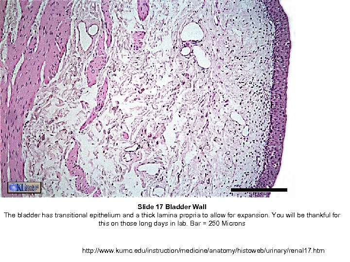Slide 17 Bladder Wall The bladder has transitional epithelium and a thick lamina propria