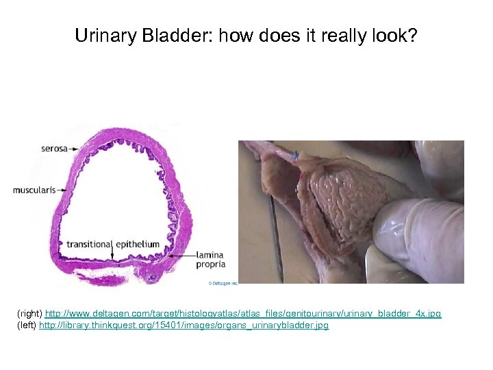 Urinary Bladder: how does it really look? (right) http: //www. deltagen. com/target/histologyatlas/atlas_files/genitourinary/urinary_bladder_4 x. jpg