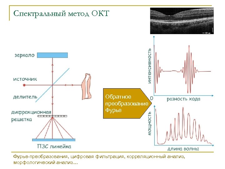 Спектральный метод ОКТ Обратное преобразование Фурье-преобразования, цифровая фильтрация, корреляционный анализ, морфологический анализ… 