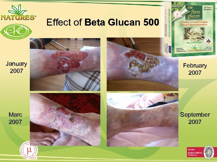 Effect of Beta Glucan 500 January 2007 February 2007 Marc 2007 September 2007 