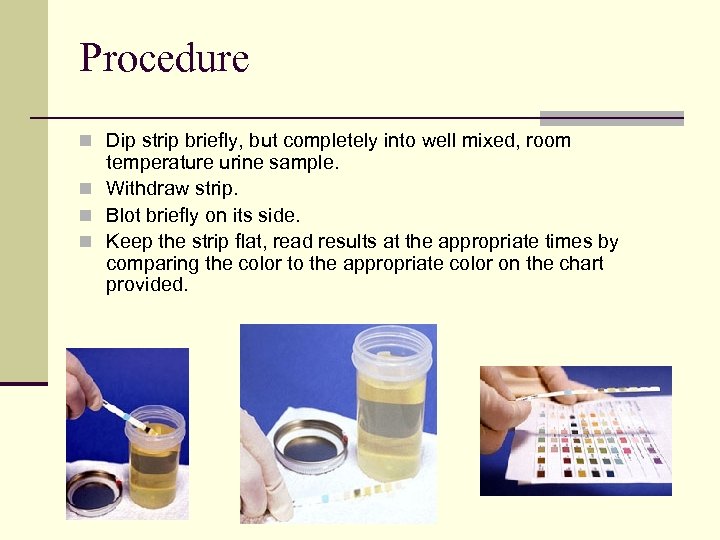 Procedure n Dip strip briefly, but completely into well mixed, room temperature urine sample.
