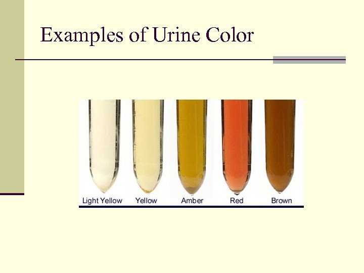 pink tissue fragments in urine