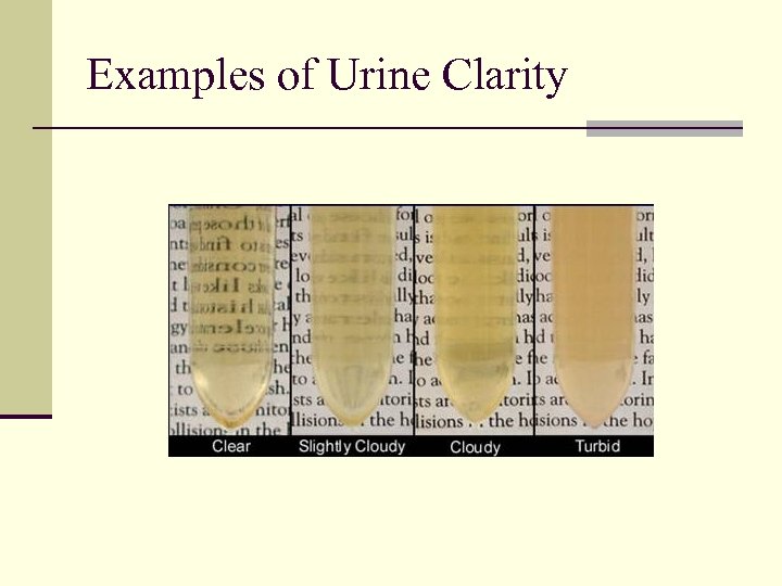 Examples of Urine Clarity 