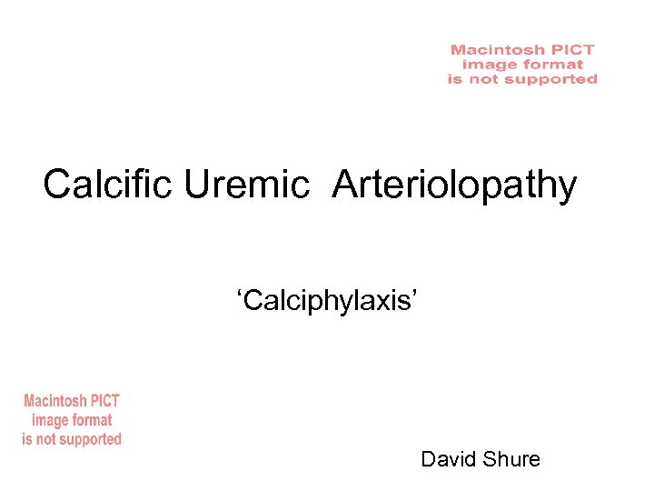 Calcific Uremic Arteriolopathy ‘Calciphylaxis’ David Shure 