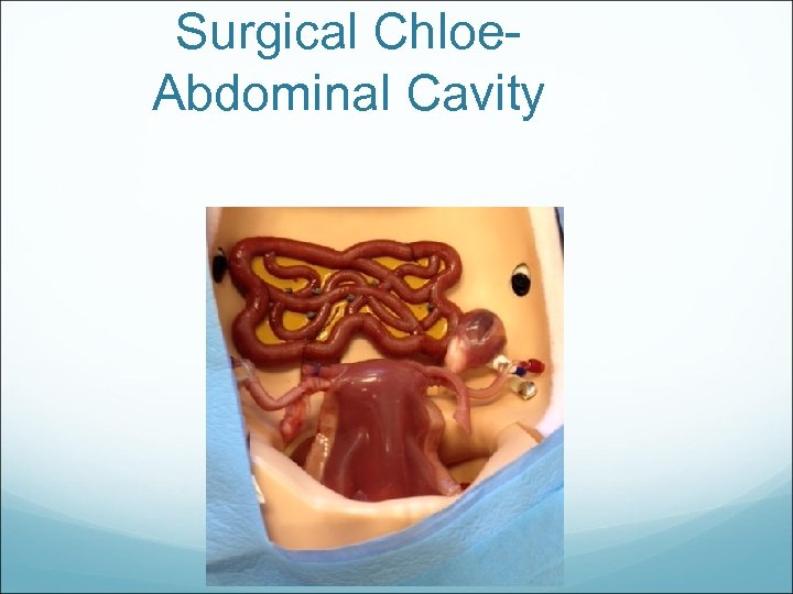 Surgical Chloe. Abdominal Cavity 