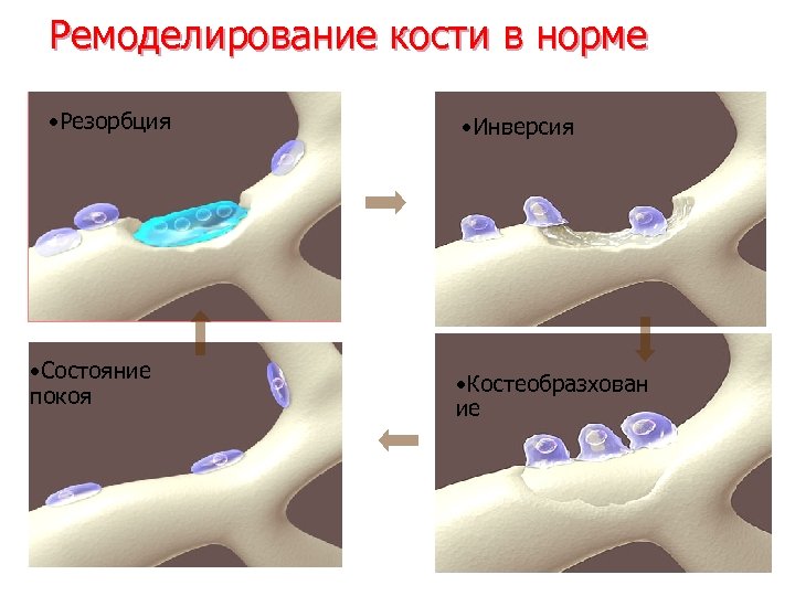 Закон вольфа кости рост. Фазы ремоделирования костной ткани. Ремоделирование костной ткани биохимия схема. Механизм ремоделирования костной ткани. Цикл ремоделирования кости.