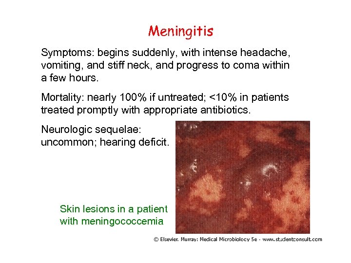Meningitis Symptoms: begins suddenly, with intense headache, vomiting, and stiff neck, and progress to