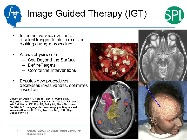 Image Guided Therapy (IGT) • Is the active visualization of medical images to aid
