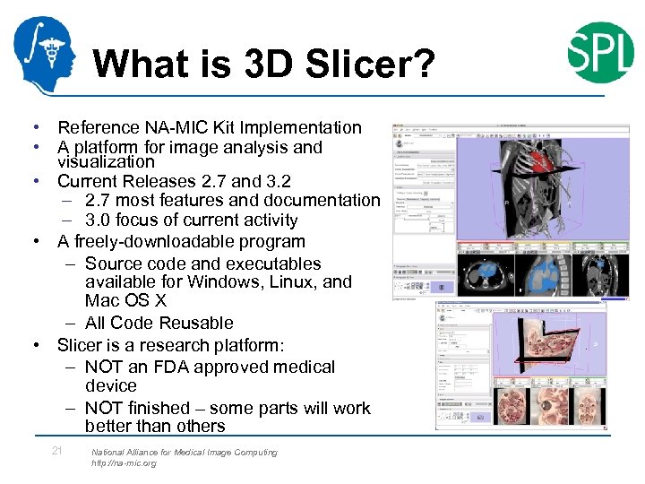 What is 3 D Slicer? • Reference NA-MIC Kit Implementation • A platform for
