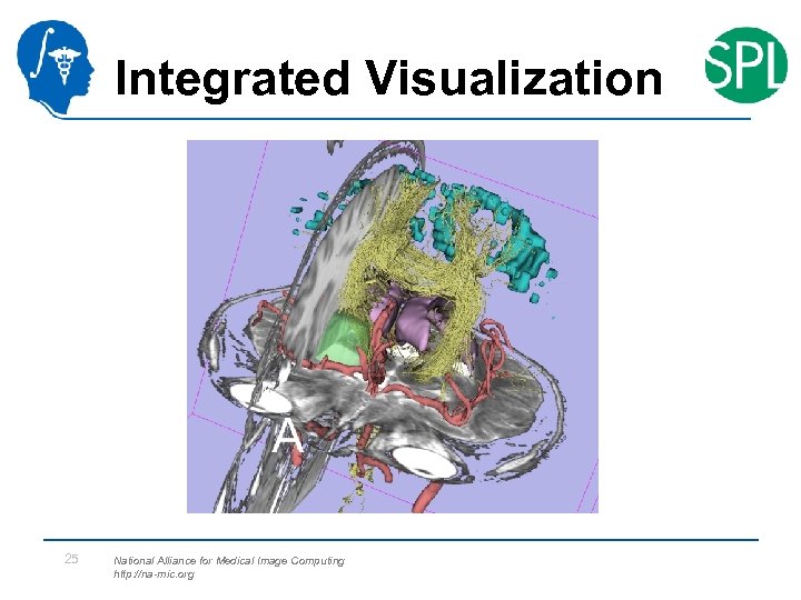 Integrated Visualization 25 National Alliance for Medical Image Computing http: //na-mic. org 