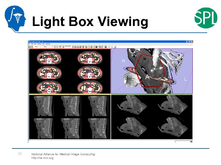 Light Box Viewing 28 National Alliance for Medical Image Computing http: //na-mic. org 