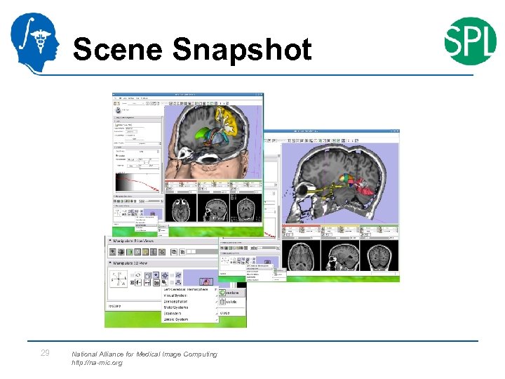 Scene Snapshot 29 National Alliance for Medical Image Computing http: //na-mic. org 