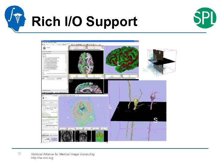 Rich I/O Support 31 National Alliance for Medical Image Computing http: //na-mic. org 