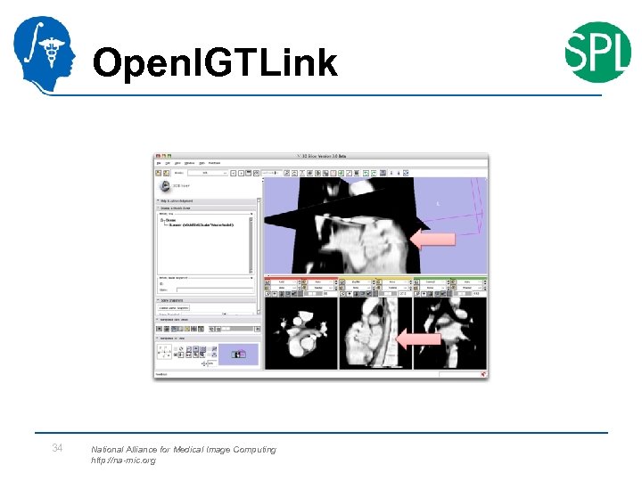 Open. IGTLink 34 National Alliance for Medical Image Computing http: //na-mic. org 