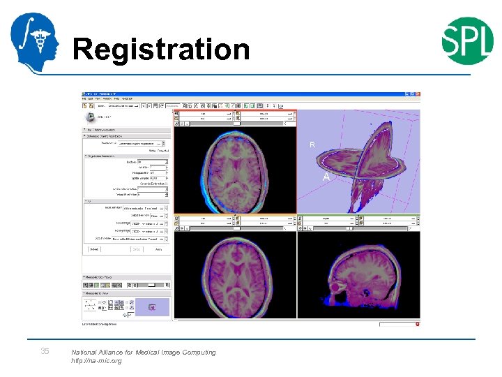 Registration 35 National Alliance for Medical Image Computing http: //na-mic. org 