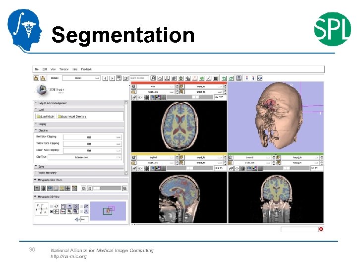 Segmentation 36 National Alliance for Medical Image Computing http: //na-mic. org 