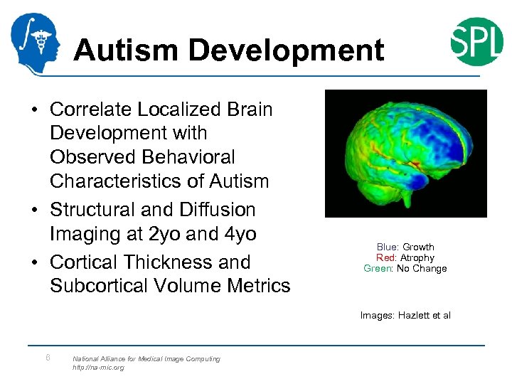 Autism Development • Correlate Localized Brain Development with Observed Behavioral Characteristics of Autism •