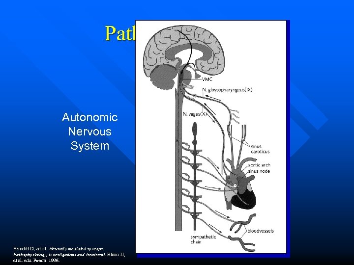 Pathophysiology Autonomic Nervous System Benditt D, et al. Neurally mediated syncope: Pathophysiology, investigations and