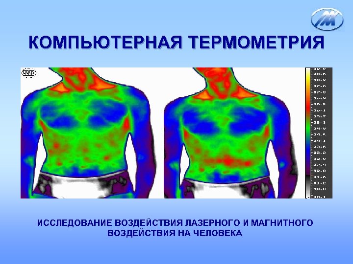 КОМПЬЮТЕРНАЯ ТЕРМОМЕТРИЯ ИССЛЕДОВАНИЕ ВОЗДЕЙСТВИЯ ЛАЗЕРНОГО И МАГНИТНОГО ВОЗДЕЙСТВИЯ НА ЧЕЛОВЕКА 