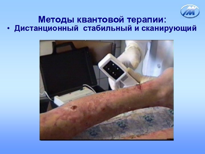 Методы квантовой терапии: • Дистанционный стабильный и сканирующий 