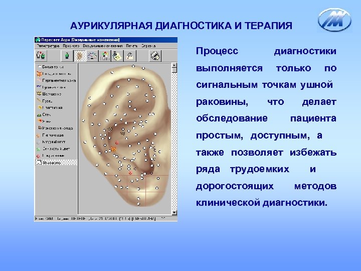 АУРИКУЛЯРНАЯ ДИАГНОСТИКА И ТЕРАПИЯ Процесс диагностики выполняется только по сигнальным точкам ушной раковины, что