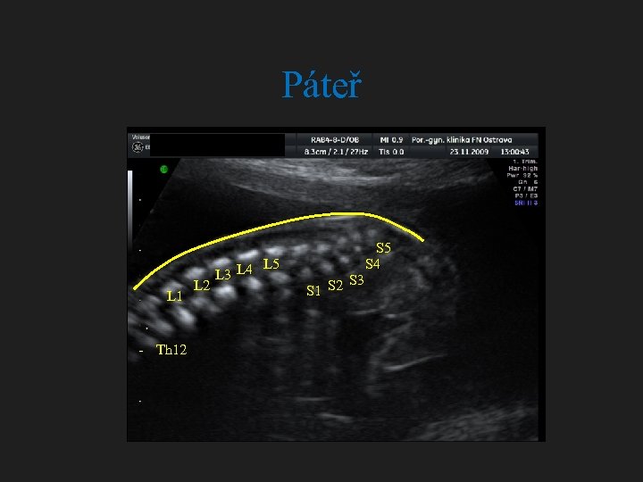 Páteř L 1 Th 12 L 5 L 3 L 4 S 5 S