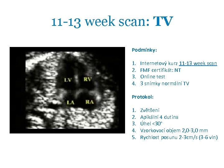 11 -13 week scan: TV Podmínky: 1. 2. 3. 4. Internetový kurz 11 -13