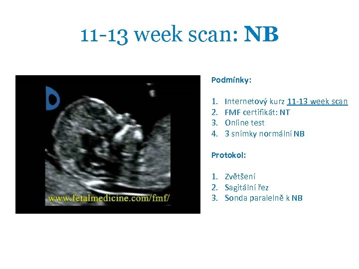 11 -13 week scan: NB Podmínky: 1. 2. 3. 4. Internetový kurz 11 -13