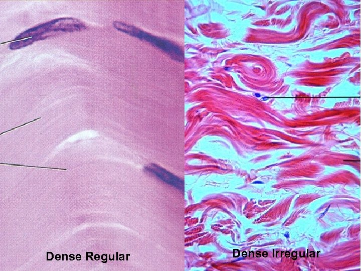 Dense Regular Dense Irregular 