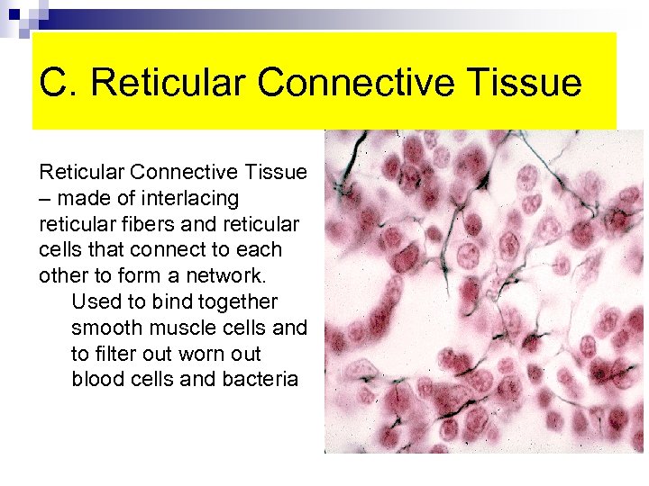 C. Reticular Connective Tissue – made of interlacing reticular fibers and reticular cells that