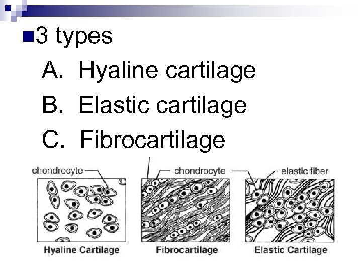 n 3 types A. Hyaline cartilage B. Elastic cartilage C. Fibrocartilage 
