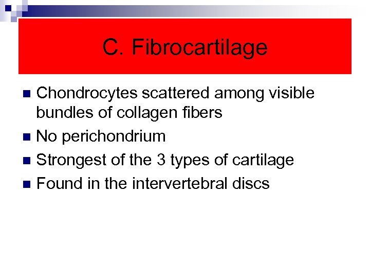 C. Fibrocartilage Chondrocytes scattered among visible bundles of collagen fibers n No perichondrium n
