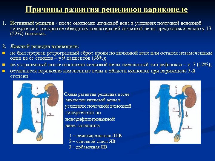 Развитие рецидивов