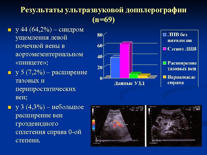 Результаты ультразвуковой допплерографии (n=69) n n n у 44 (64, 2%) – синдром ущемления