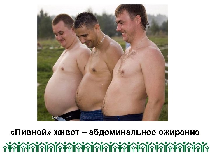  «Пивной» живот – абдоминальное ожирение 